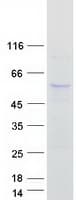 Human ABHD8 Protein (Recombinant Myc-DDK (Flag))