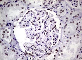 NBN / Nibrin Antibody (clone OTI6E11)