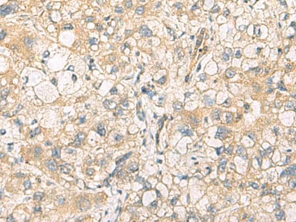 Polyclonal Rabbit anti-Human DNAJA4 Antibody (IHC, WB)
