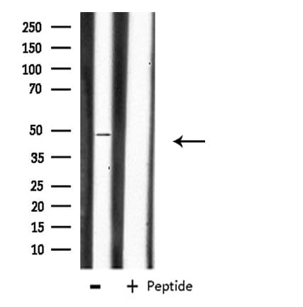 CHST1 Antibody