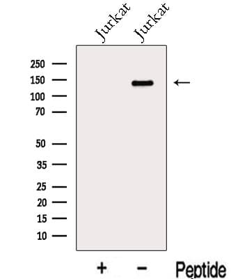 GSE1 / KIAA0182 Antibody