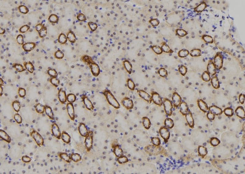 Polyclonal Rabbit anti-Human NBPF4 Antibody (IHC, WB)