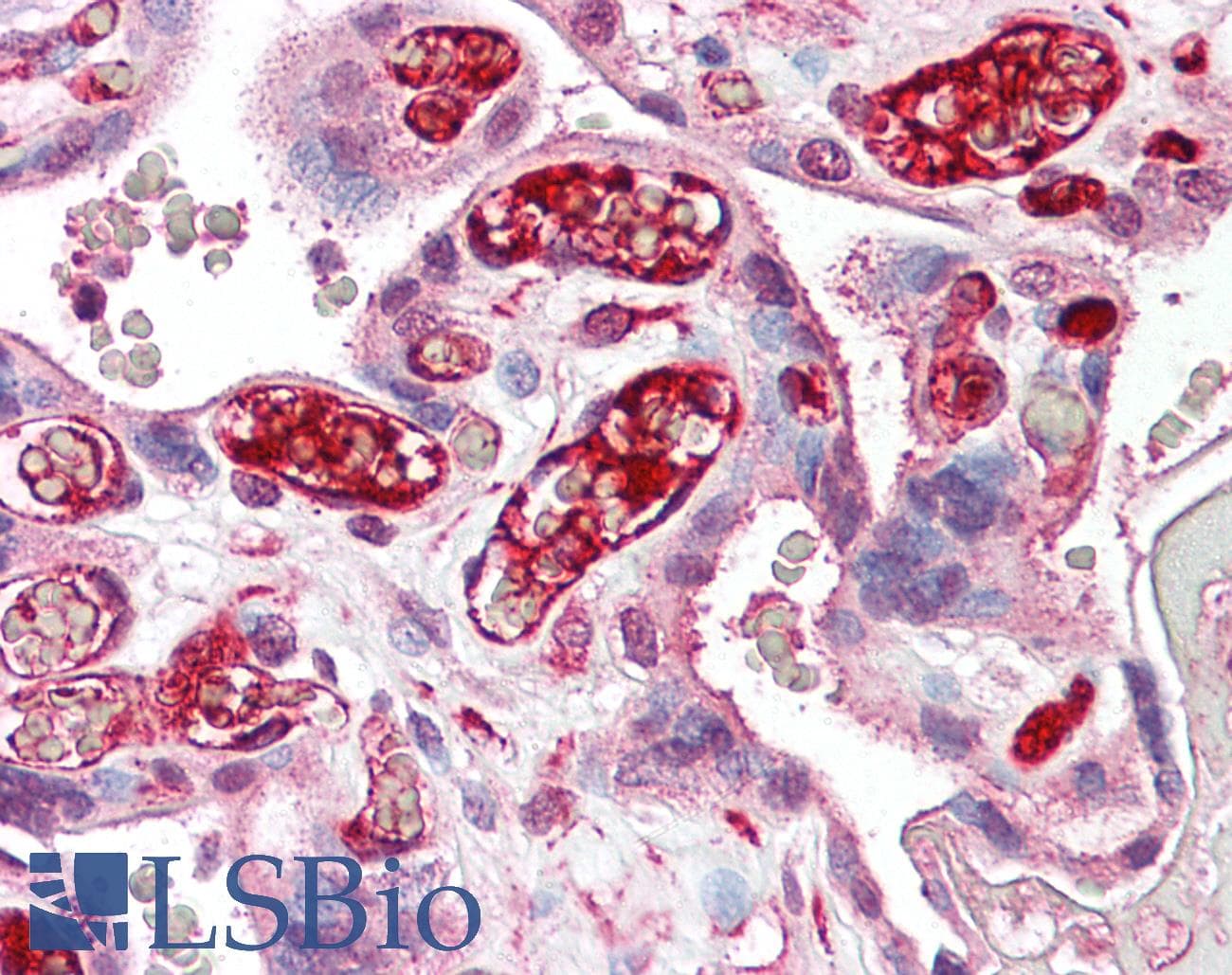 Polyclonal Rabbit anti-Human NFE2L3 Antibody (aa351-400, IHC, WB)