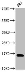 Polyclonal Rabbit anti-Human HIST1H3A Antibody (IHC, WB)