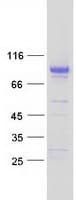 Human MFRP Protein (Recombinant Myc-DDK (Flag))