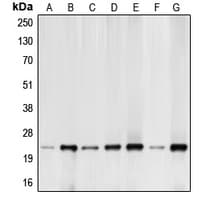 BCL2L11 / BIM Antibody (N-Terminus)