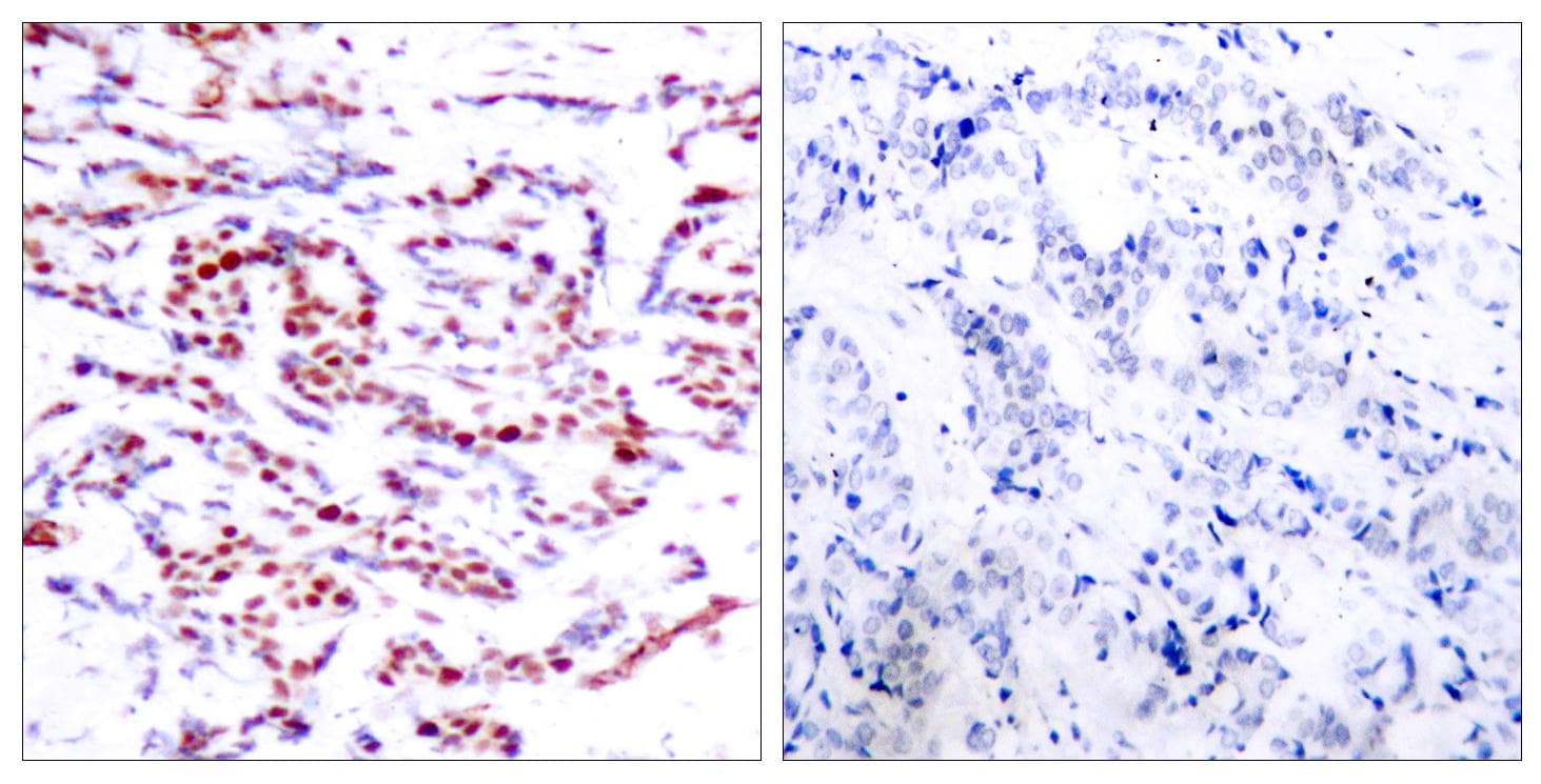Polyclonal Rabbit anti-Human ATF2 Antibody (phospho-Thr71 or 53, IHC, WB)