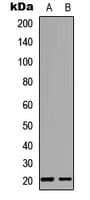 MED28 / Magicin Antibody (Internal)