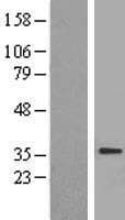 Human SLC25A4 / ANT Protein (Over-Expression Lysate Myc-DDK (Flag))