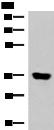 KCNK15 Antibody