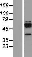 Human CTSW / Cathepsin W Protein (Over-Expression Lysate Myc-DDK (Flag))