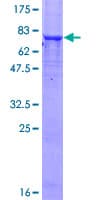 Human PGM5 / Aciculin Protein (Recombinant GST)