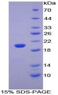 Mouse PHLDA2 / TSSC3 Protein (Recombinant His-T7)