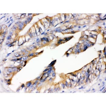 AGER / RAGE Antibody (aa91-120)