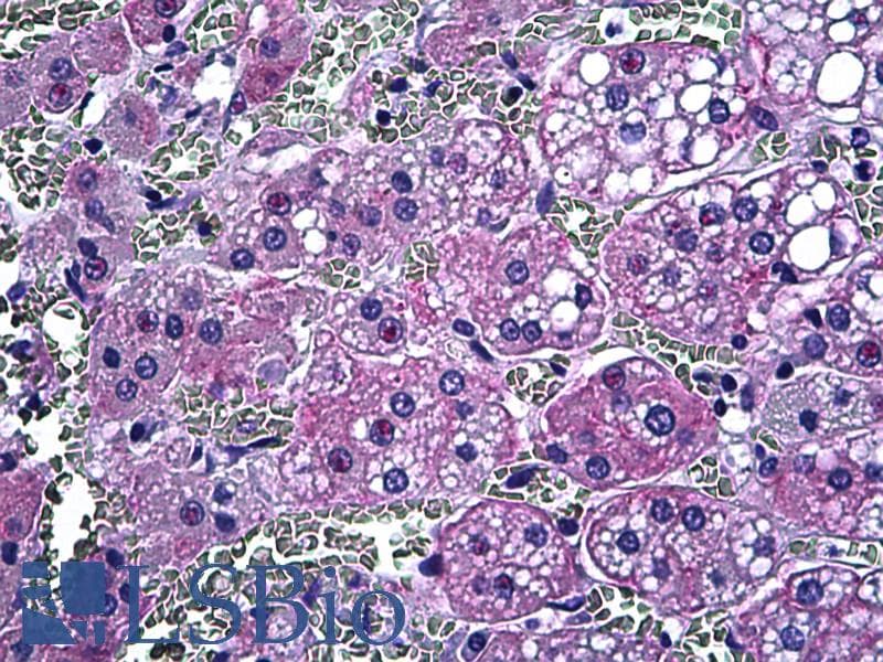 IHC-plus™ ABCB1 / MDR1 / P Glycoprotein Antibody (clone JSB-1)