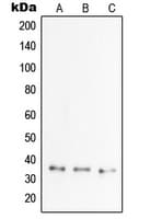 Polyclonal Rabbit anti-Human TNFAIP6 / TSG-6 Antibody (Internal, IHC, WB)