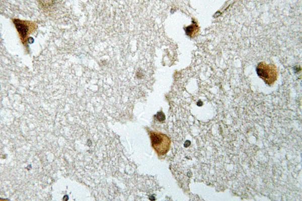 ALDOB Antibody (Trp148)