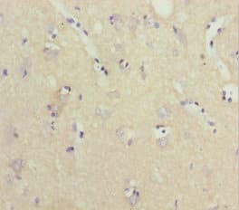 Polyclonal Rabbit anti-Human NPTN / SDR1 Antibody (IHC, WB)