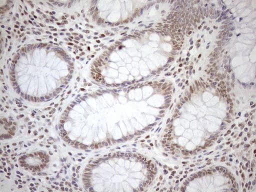 MGMT Antibody (clone OTI4F9)