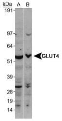 SLC2A4 / GLUT-4 Antibody (aa480-509)