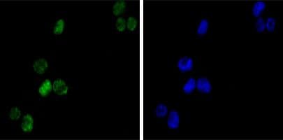 Monoclonal Mouse anti-Human GATA1 Antibody (clone 4F5, IHC, IF, WB)