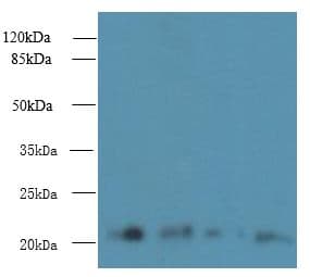 Polyclonal Rabbit anti-Human MRPL18 Antibody (IHC, WB)