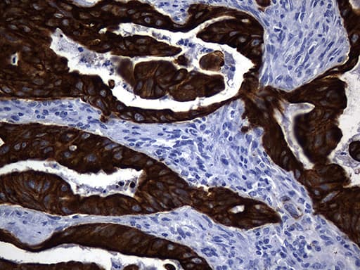 Monoclonal Mouse anti-Human KRT84 / Keratin 84 / KRTHB4 Antibody (clone OTI2D1, IHC, WB)