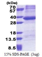 Human PPP1R3B Protein (Recombinant His)