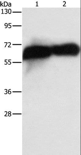 PLAP / Alkaline Phosphatase Antibody