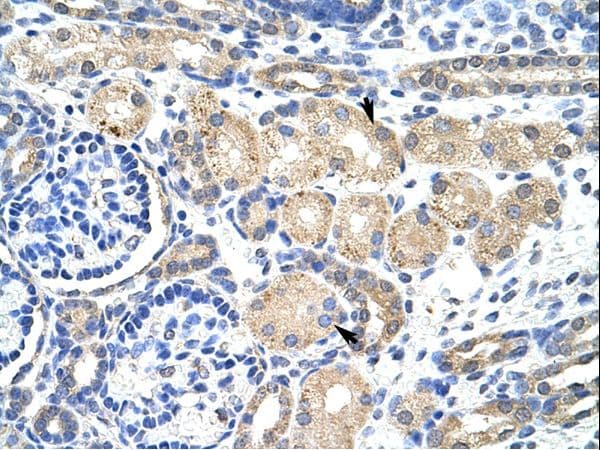 Polyclonal Rabbit anti-Human KCNAB2 / Kv-Beta-2 Antibody (aa121-170, IHC, WB)