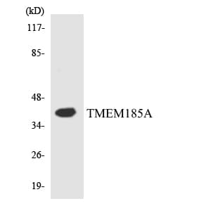 Polyclonal Rabbit anti-Human TMEM185A / FAM11A Antibody (aa280-329, WB)