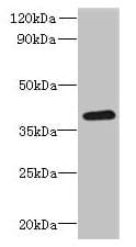 Polyclonal Rabbit anti-Human RSPH14 / RTDR1 Antibody (IHC, WB)
