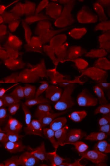 PathPlus™ SMARCB1 / INI1 Antibody