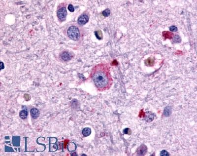 IHC-plus™ GRM1 / MGLUR1 Antibody (N-Terminus)