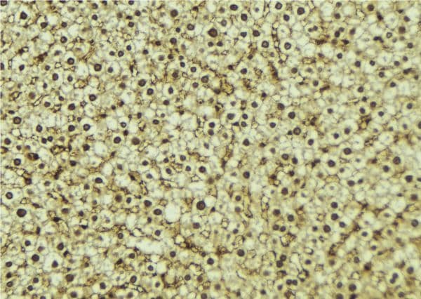 JADE1 / PHF17 Antibody