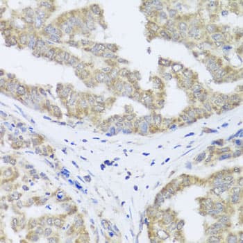 Polyclonal Rabbit anti-Human TIMM10B / FXC1 Antibody (IHC, WB)