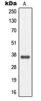 IHC-plus™ Polyclonal Rabbit anti-Human MC4R / Melanocortin 4 Receptor Antibody (C-Terminus, IHC, WB)
