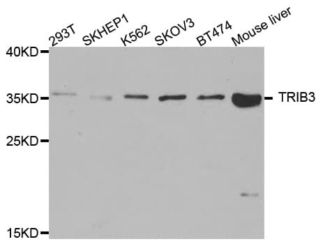 TRB3 / TRIB3 Antibody