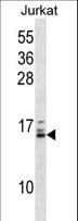 HIST1H2BB Antibody (aa1-30)