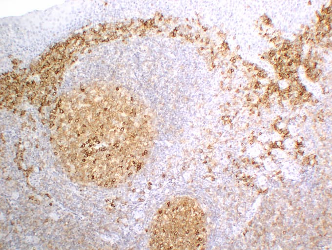 CD3E Antibody (clone ABT-CD3)