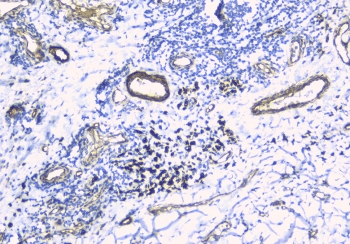 TEK / TIE2 Antibody