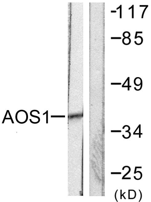 Polyclonal Rabbit anti-Human SAE1 Antibody (IF, WB)