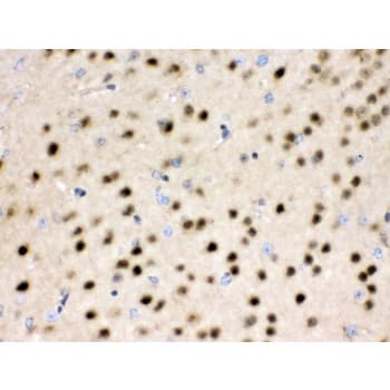 HDAC11 Antibody (aa47-81)