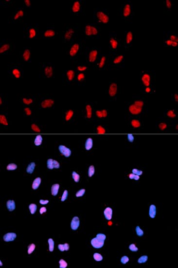 c-Met Antibody (phospho-Tyr1234)
