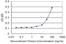 COL5A1 / Collagen V Alpha 1 Antibody (clone 2F4)