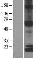 NDUFS8 Protein (Over-Expression Lysate Myc-DDK (Flag))