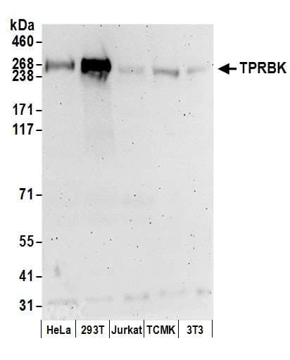 TTC28 Antibody (aa2450-2500)