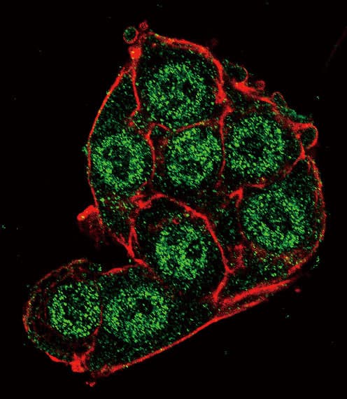 Polyclonal Rabbit anti-Human PDK4 Antibody (aa83-111, IHC, IF, WB)