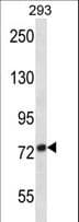 ADAM32 Antibody (aa141-169)