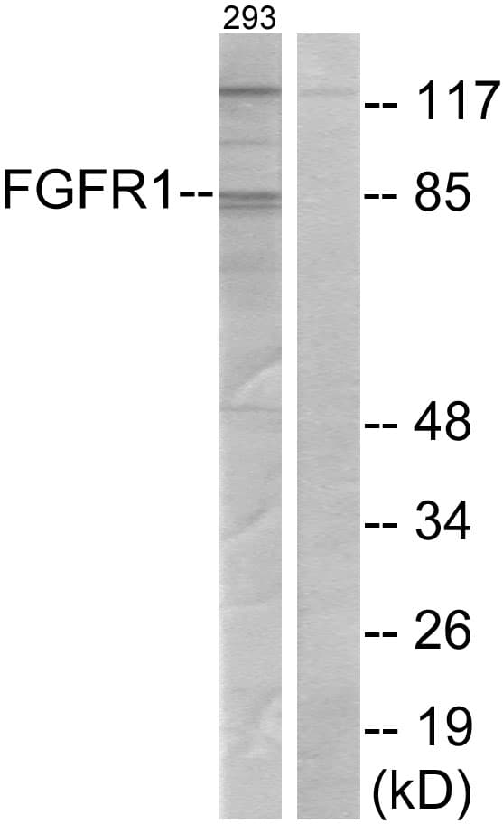 Polyclonal Rabbit anti-Human FGFR1 / FGF Receptor 1 Antibody (aa121-170, WB)